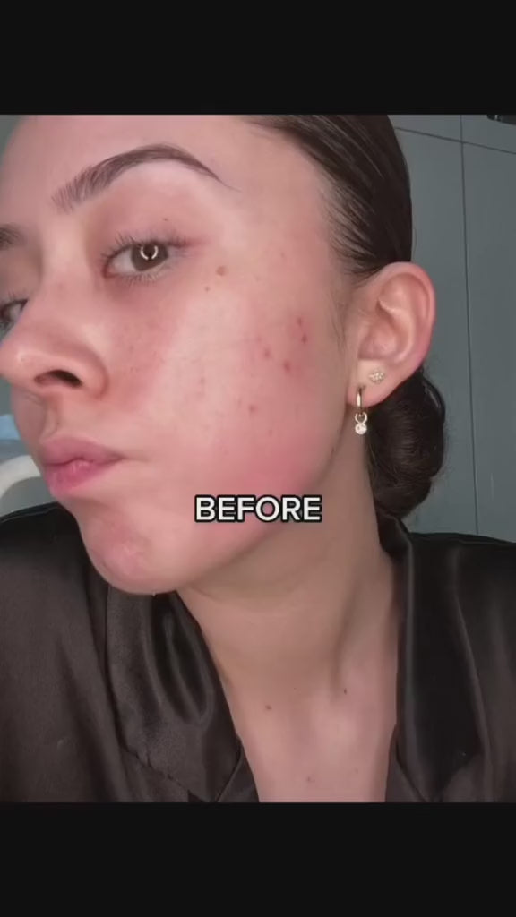 Anti Aging Red Light Therapy